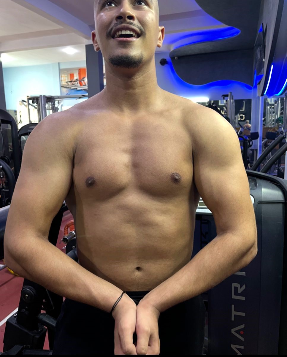 Photo avant transformation - Med